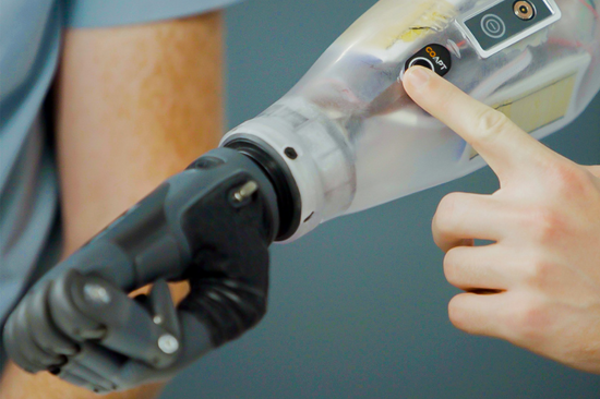 Precise EMG Signal Detection